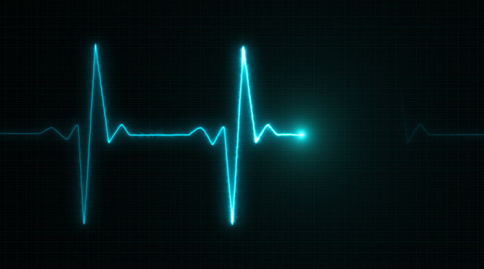 immagine di un elettrocardiogramma