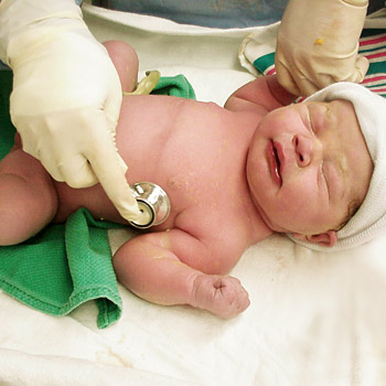 immagine di una visita a un neonato