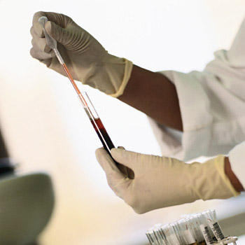 immagine di un ricercatore che esamina sangue
