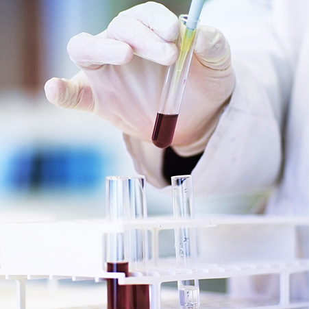 immagine di un laboratorio con fiale di sangue