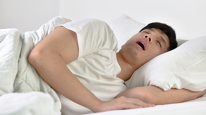 Apnee ostruttive del sonno (Osas)